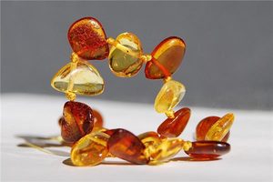 足首にブレスレットを付ける際の注意点